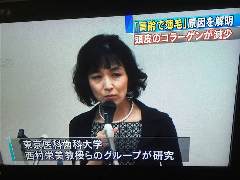 TVニュース