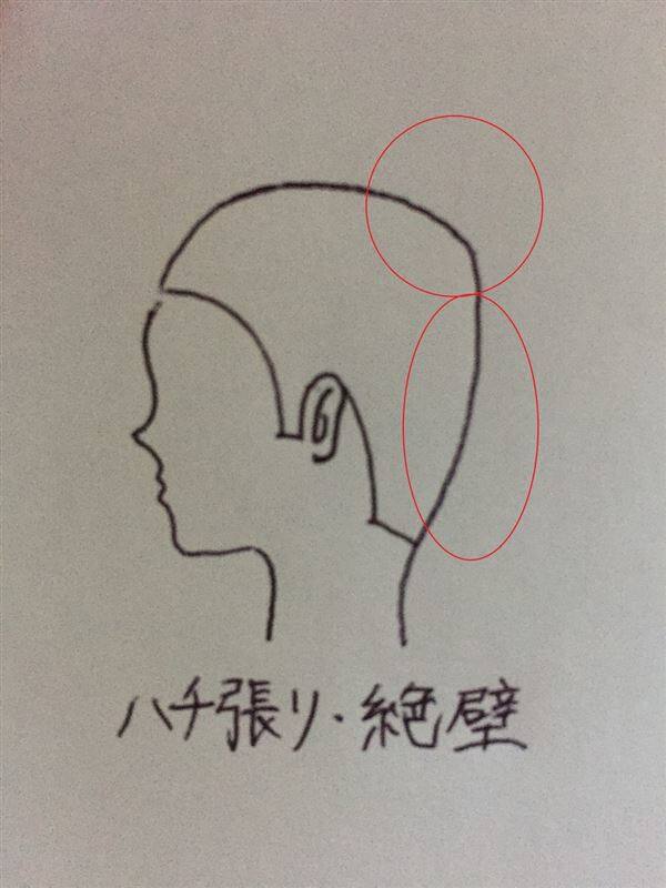 頭