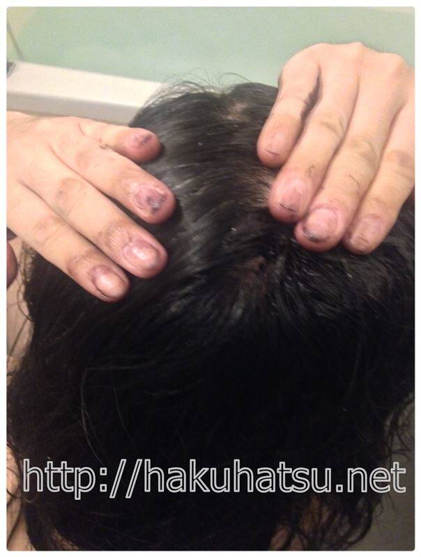 白髪染めトリートメントで分け目を染める美容師パパ本人
