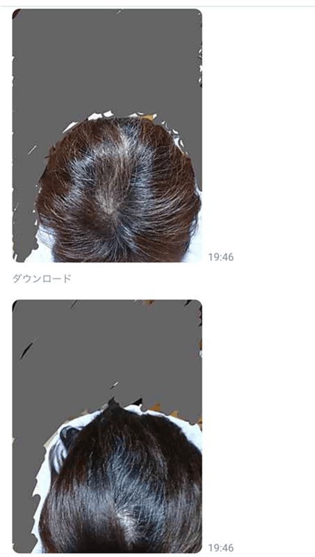 ロレアルパリクチュールのLINE相談
