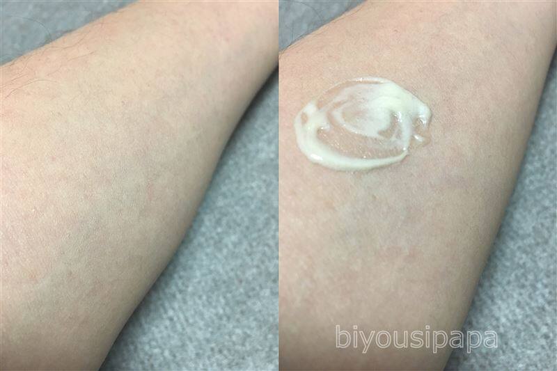 白髪染めのアレルギー症状の確認