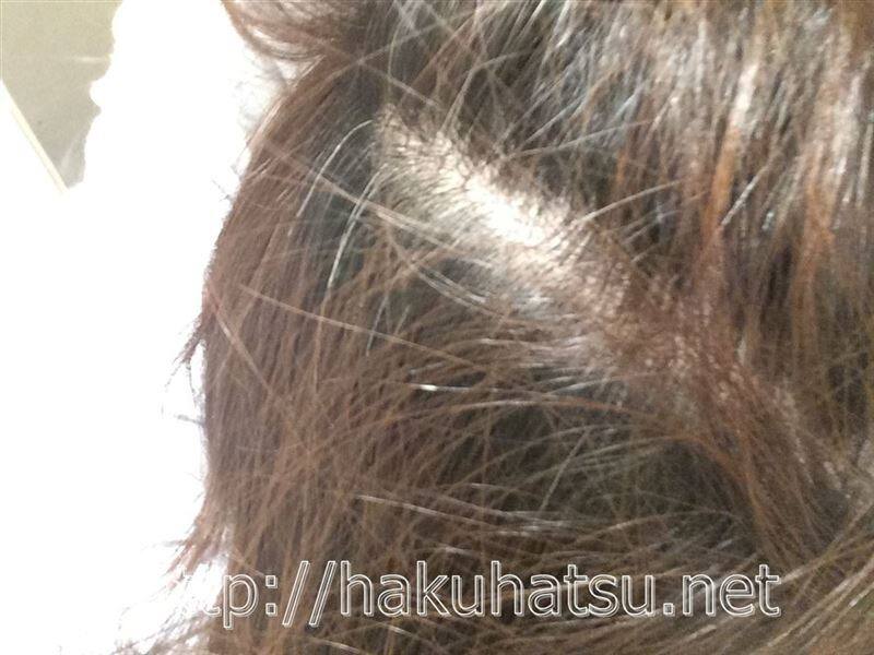 白髪染めが染まらない相談の白髪