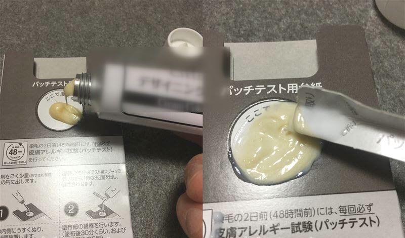 パッチテストの様子